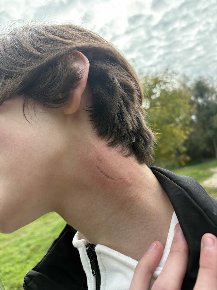 Couple kissing neck creating love bite mark close up