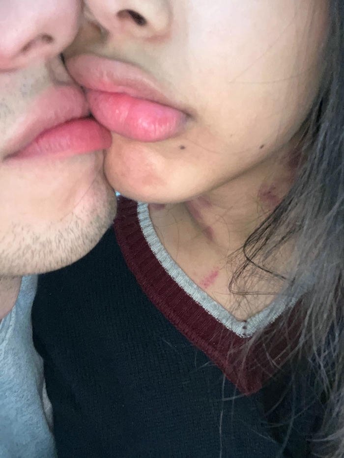 Love bites images couple intimate kissing neck biting skin view