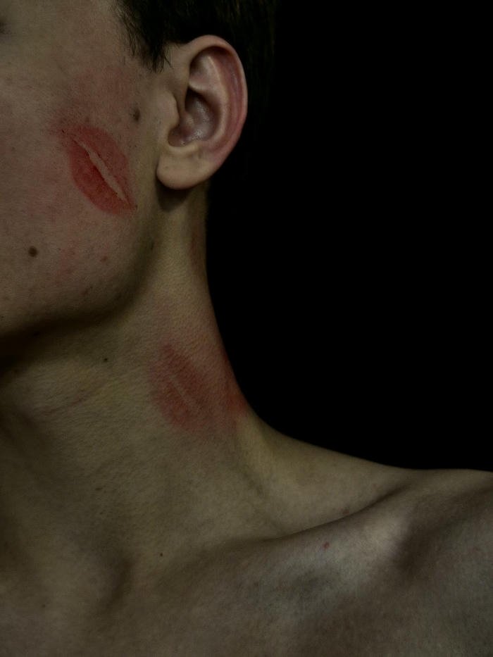 Love bites images side profile dark lighting neck bruise view