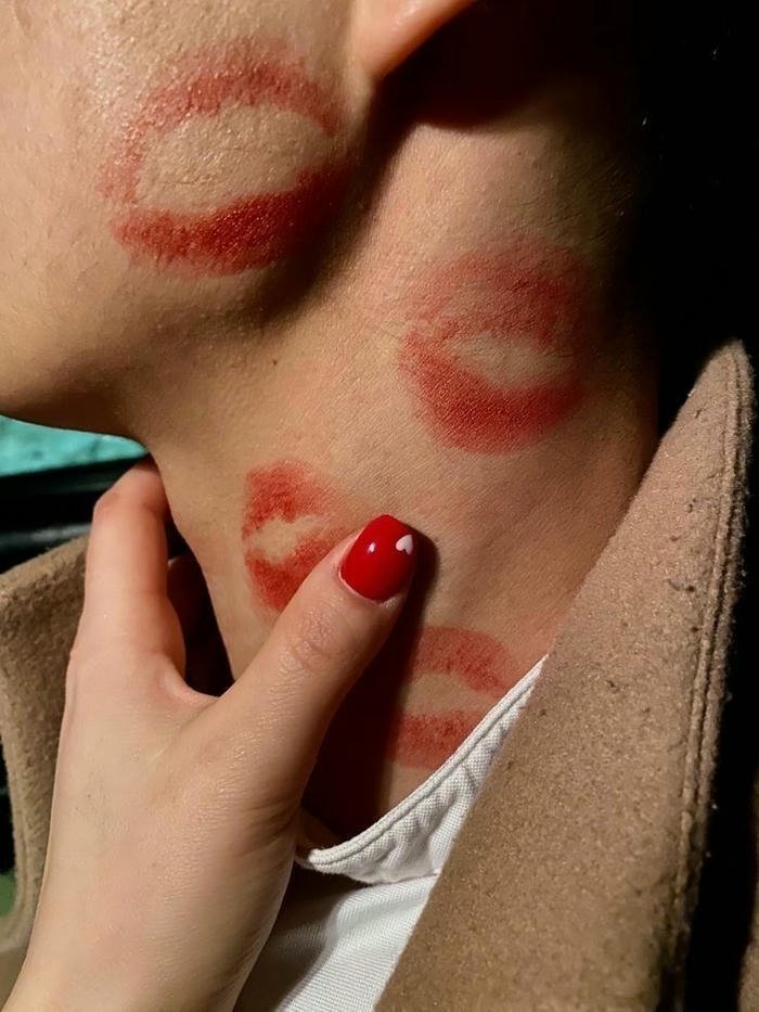 Love bites images woman hand touching red marks on neck