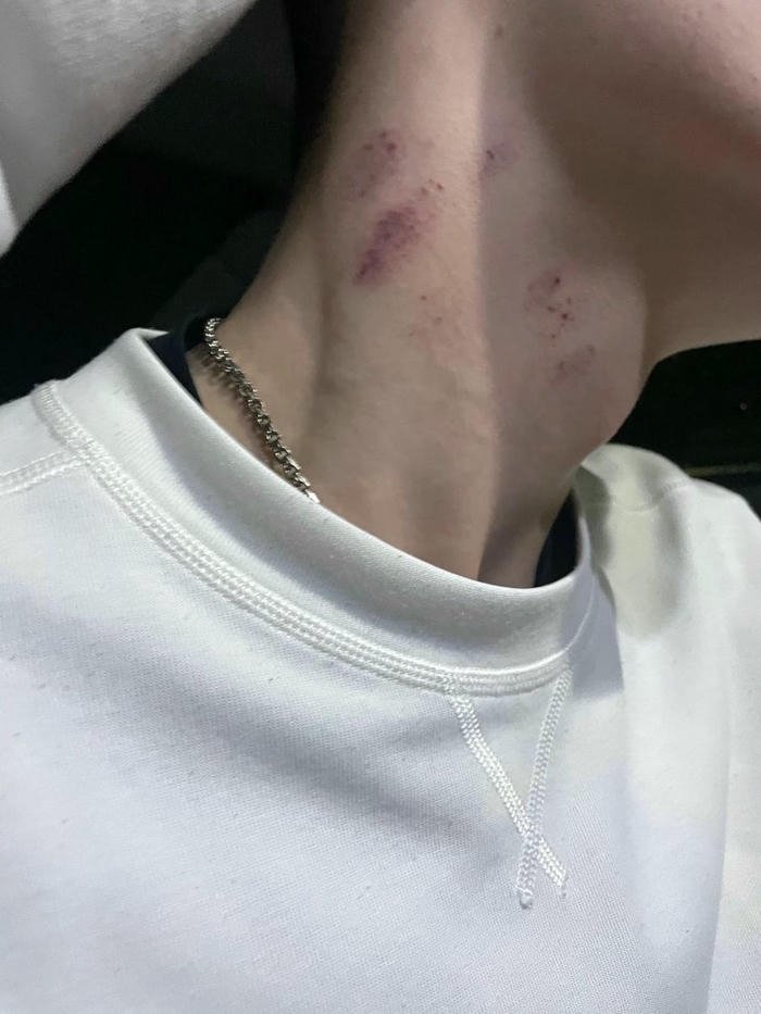 Neck kiss mark white shirt collar revealing skin view